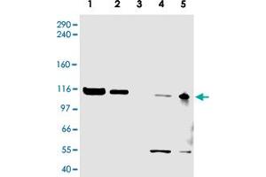 Western blot using ATAD5 polyclonal antibody  shows detection of a band ~120 KDa corresponding to human ATAD5 (arrowhead) in various cell lysates.