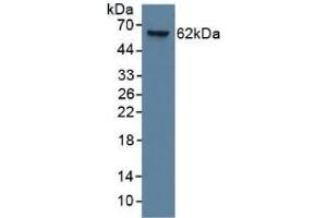 Detection of CK9 in Human Lung Tissue using Monoclonal Antibody to Cytokeratin 9 (CK9) (KRT9 Antikörper  (AA 315-456))