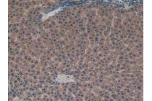 IHC-P analysis of Rat Liver Tissue, with DAB staining. (FGFRL1 Antikörper  (AA 164-368))