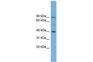 Image no. 1 for anti-Hemochromatosis (HFE) (AA 35-84) antibody (ABIN6744769) (HFE Antikörper  (AA 35-84))