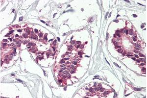 ABIN571172 (3. (IGF2BP1 Antikörper  (Internal Region))