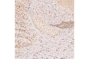 IHC analysis of SGCE using anti-SGCE antibody (ABIN7601544). (SGCE Antikörper  (AA 38-407))