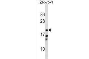 Western Blotting (WB) image for anti-Carbonyl Reductase 4 (CBR4) antibody (ABIN5019097) (CBR4 Antikörper)