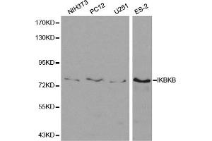 Western blot analysis of extracts of various cell lines, using IKBKB antibody (ABIN5971113) at 1/500 dilution. (IKBKB Antikörper)