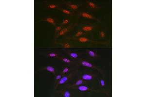 Immunofluorescence analysis of U2OS cells using Phospho-c-Jun-T91 Rabbit pAb (ABIN7268058) at dilution of 1:50 (40x lens). (C-JUN Antikörper  (pThr91))