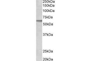 Western Blotting (WB) image for Activin A Receptor Type II-Like 1 (ACVRL1) peptide (ABIN369289) (Activin A Receptor Type II-Like 1 (ACVRL1) Peptid)