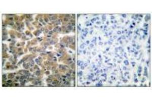 Immunohistochemistry (IHC) image for anti-Nuclear Receptor Subfamily 3, Group C, Member 1 (Glucocorticoid Receptor) (NR3C1) (Ser211) antibody (ABIN7180015)