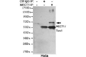 Immunoprecipitation analysis of Hela cell lysate using MECT1 / Torc1 mouse mAb. (CRTC1 Antikörper)