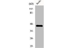 Western Blot analysis of Jurkat cells using FAM80A Polyclonal Antibody (RIMKLA Antikörper  (Internal Region))