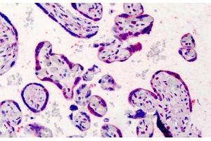 Human Placenta: Formalin-Fixed, Paraffin-Embedded (FFPE) (Bcl-2 Antikörper  (FITC))