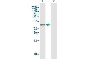 Western Blot analysis of TNFRSF13C expression in transfected 293T cell line by TNFRSF13C MaxPab polyclonal antibody. (TNFRSF13C Antikörper  (AA 1-184))