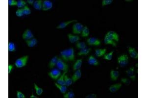 Immunofluorescence staining of Hela cells with ABIN7144538 at 1:133, counter-stained with DAPI. (ALOX15 Antikörper  (AA 1-225))