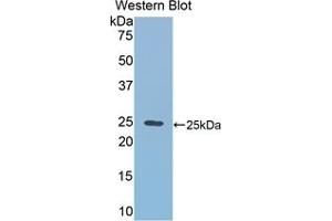 Detection of Recombinant RALBP1, Mouse using Polyclonal Antibody to RalA Binding Protein 1 (RALBP1) (RALBP1 Antikörper  (AA 192-380))
