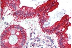 Human Colon (formalin-fixed, paraffin-embedded) stained with UBE2L3 antibody ABIN462238 followed by biotinylated goat anti-rabbit IgG secondary antibody ABIN481713, alkaline phosphatase-streptavidin and chromogen. (UBE2L3 Antikörper  (C-Term))