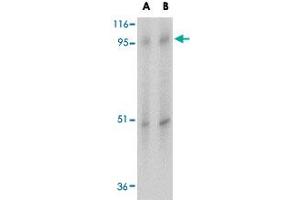 Western blot analysis of SLC39A10 in human spleen tissue lysate with SLC39A10 polyclonal antibody  at (A) 1 and (B) 2 ug/mL . (SLC39A10 Antikörper  (Internal Region))