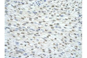 Rabbit Anti-SF3A1 antibody         Paraffin Embedded Tissue:  Human Heart    cell Cellular Data:  cardiac cell    Antibody Concentration:  4. (SF3A1 Antikörper  (N-Term))