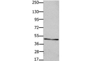 Western Blot analysis of OP9 cell using Connexin 47 Polyclonal Antibody at dilution of 1:450 (GJC2 Antikörper)