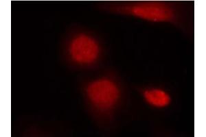 Image no. 1 for anti-Androgen Receptor (AR) (pSer213) antibody (ABIN319225) (Androgen Receptor Antikörper  (pSer213))