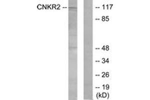 Western blot analysis of extracts from Jurkat cells, using CNKR2 Antibody. (CNKSR2 Antikörper  (AA 641-690))
