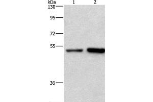 Western Blot analysis of Hela and Jurkat cell using SYT4 Polyclonal Antibody at dilution of 1:700 (SYT4 Antikörper)