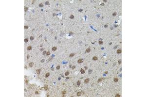 Immunohistochemistry of paraffin-embedded rat brain using MYCN antibody. (MYCN Antikörper)