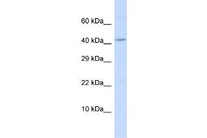 Host:  Rabbit  Target Name:  BM Sample Type:  MCF7 Whole Cell lysates  Antibody Dilution:  1. (BMP10 Antikörper  (C-Term))