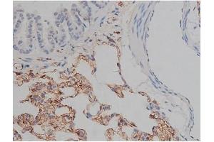 ABIN6255310 and ABIN6267356 at 1/200 staining Rat lung tissue sections by IHC-P.