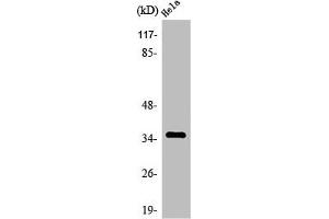 Western Blot analysis of MCF7 cells using Olfactory receptor 4C13 Polyclonal Antibody (OR4C13 Antikörper  (C-Term))