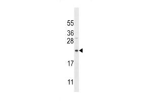 Bit1 Antibody (K95) (ABIN650622 and ABIN2846297) western blot analysis in MDA-M cell line lysates (35 μg/lane). (PTRH2 Antikörper  (AA 80-110))