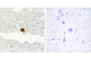 Peptide - +Immunohistochemistry analysis of paraffin-embedded human brain tissue, using DGKZ antibody.
