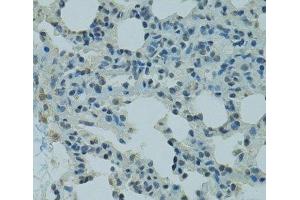 Immunohistochemistry of paraffin-embedded Rat lung using PRDM2 Polyclonal Antibody at dilution of 1:100 (40x lens). (PRDM2 Antikörper)