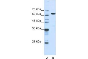 Western Blotting (WB) image for anti-Nuclear RNA Export Factor 1 (NXF1) antibody (ABIN2462207)