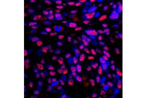 Immunofluorescence (IF) image for anti-Replication Protein A2, 32kDa (RPA2) (C-Term) antibody (ABIN7449012)