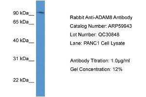 WB Suggested Anti-ADAM8  Antibody Titration: 0. (ADAM8 Antikörper  (N-Term))