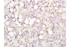 Formalin-fixed and human liver tissue labeled with Anti-USP-1 Polyclonal Antibody, Unconjugated  at 1:200 followed by conjugation to the secondary antibody and DAB staining (USP1 Antikörper  (AA 701-785))