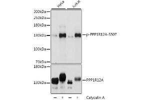 Western blot analysis of extracts of various cell lines, using Phospho-PPP1R12A-S507 antibody (ABIN6135287, ABIN6136196, ABIN6136197 and ABIN6225664) at 1:2000 dilution or PPP1R12A antibody (ABIN6128260, ABIN6146059, ABIN6146061 and ABIN6213896). (PPP1R12A Antikörper  (pSer507))