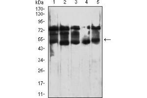 Western blot analysis using CD364 mouse mAb against THP-1 (1), PC-3 (2), LNCAP (3), Jurkat (4), and A431 (5) cell lysate.