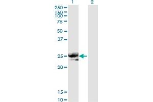 Western Blot analysis of NOG expression in transfected 293T cell line by NOG monoclonal antibody (M11), clone 2C10. (NOG Antikörper  (AA 27-145))