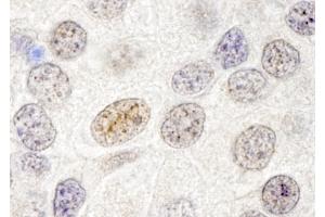 Immunohistochemistry (IHC) image for anti-GATA Zinc Finger Domain Containing 2B (GATAD2B) (AA 50-100) antibody (ABIN7448709) (GATAD2B Antikörper  (AA 50-100))
