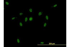Image no. 1 for anti-CSE1 Chromosome Segregation 1-Like (CSE1L) (AA 872-972) antibody (ABIN465991) (Exportin 2 Antikörper  (AA 872-972))