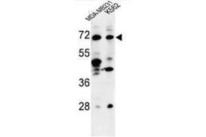 Western blot analysis of C21orf29 Antibody (Center) in MDA-MB231, K562 cell line lysates (35µg/lane). (TSPEAR Antikörper  (Middle Region))