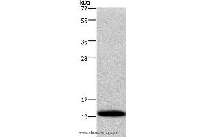 Western blot analysis of Human fetal liver tissue, using COX6B1 Polyclonal Antibody at dilution of 1:1200 (COX6B1 Antikörper)
