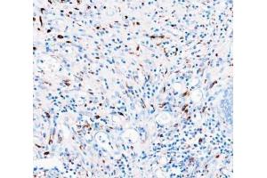 IHC analysis of CD68 using anti-CD68 antibody (ABIN7600142). (CD68 Antikörper  (AA 154-354))