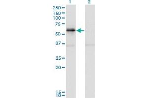 Western Blot analysis of PAK1 expression in transfected 293T cell line by PAK1 monoclonal antibody (M02), clone 4D1.