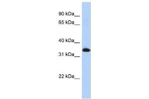 ZNF511 antibody used at 0. (ZNF511 Antikörper  (N-Term))