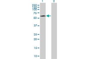 Western Blot analysis of STIP1 expression in transfected 293T cell line by STIP1 MaxPab polyclonal antibody. (STIP1 Antikörper  (AA 1-543))