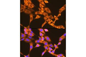 Immunofluorescence analysis of NIH-3T3 cells using F/UBD Rabbit mAb (ABIN7271134) at dilution of 1:100 (40x lens). (UBD Antikörper)