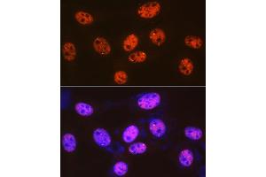 Immunofluorescence analysis of NIH-3T3 cells using 53BP1 Rabbit mAb (ABIN1679832, ABIN3018199, ABIN3018200 and ABIN7101582) at dilution of 1:100 (40x lens). (TP53BP1 Antikörper)