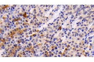 Detection of CASP3 in Rat Stomach Tissue using Polyclonal Antibody to Caspase 3 (CASP3)