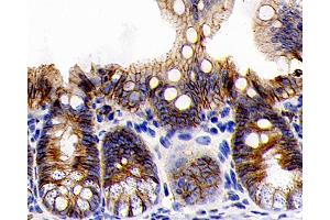 Immunohistochemistry (Paraffin-embedded Sections) (IHC (p)) image for anti-Cadherin 1, Type 1, E-Cadherin (Epithelial) (CDH1) antibody (ABIN7249790)